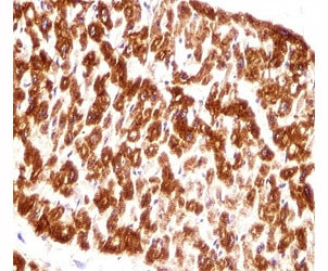 Anti-Desmin (Muscle cell marker)