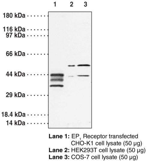 Anti-EP1 Receptor