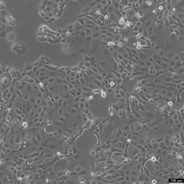 HCC78 Cells
