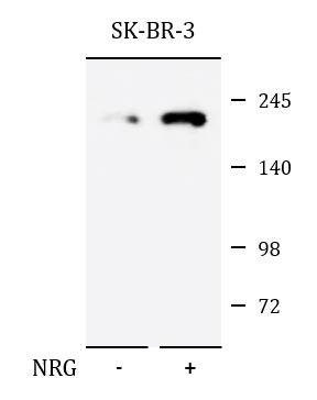 Anti-phospho-ERBB2 / HER2 (Tyr1140)