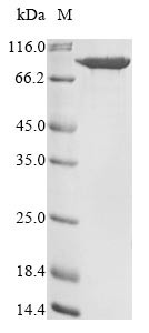 Multifunctional procollagen lysine hydroxylase and glycosyltransferase LH3 (PLOD3), human, recombina