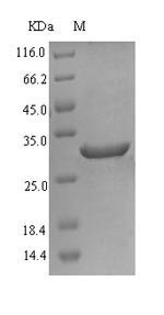 Acyl-CoA 6-desaturase (FADS2), partial, human, recombinant