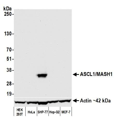 Anti-ASCL1/MASH1 Recombinant Monoclonal