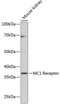 Anti-MC1 Receptor [KO Validated]