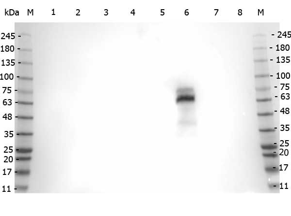 Anti-Myeloperoxidase, human leukocytes (MPO, pANCA)