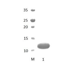 PDZD7_1 PDZ Domain