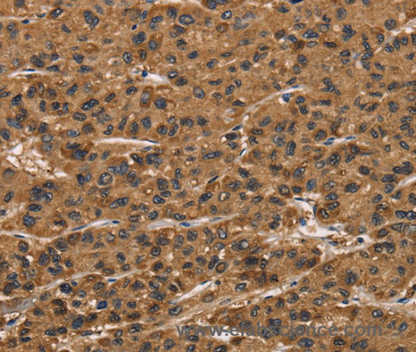 Anti-ATP7A
