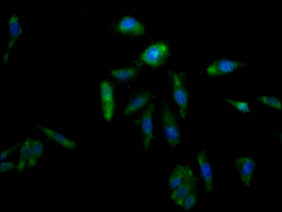 Anti-AKR1C3 Recombinant Monoclonal, clone 4D12