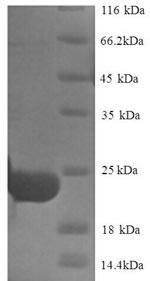 Trypsin inhibitor DE-3, Erythrina caffra, recombinant