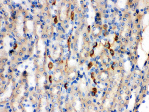 Anti-Kininogen 1