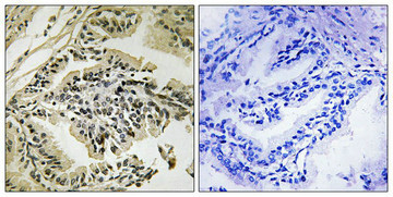 Anti-Phospho-EIF2AK3 (Thr981)