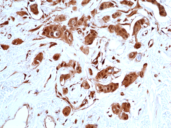 Anti-Stat3, Rabbit Monoclonal (RM465)