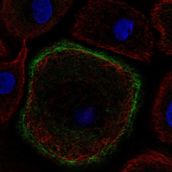 Anti-TNNI2