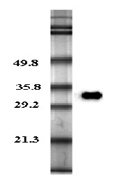 Anti-Adiponectin (human), Biotin conjugated