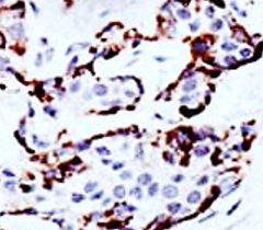 Anti-KMT1B / SUV39H2