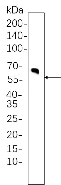 Anti-Recombinant Tyrosine Hydroxylase, clone 5C9