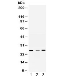 Anti-Sorcin / SRI