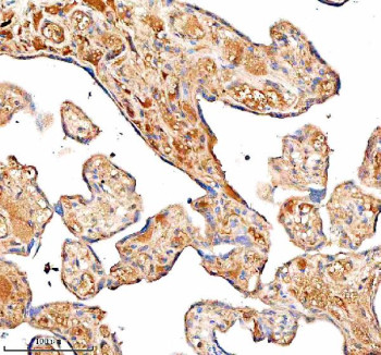 Anti-C1 Inhibitor (C1-INH) / SERPING1