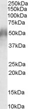 Anti-CD2BP2, N-terminal
