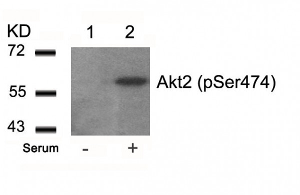 Anti-phospho-Akt2 (Ser474)
