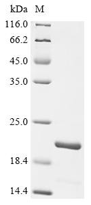 Aquaporin-5 (AQP5), partial, human, recombinant