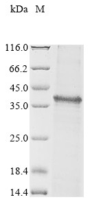 Tenomodulin (Tnmd), partial, mouse, recombinant
