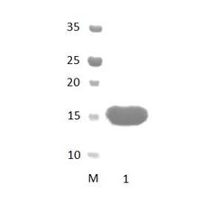 ARHGAP21 PDZ Domain