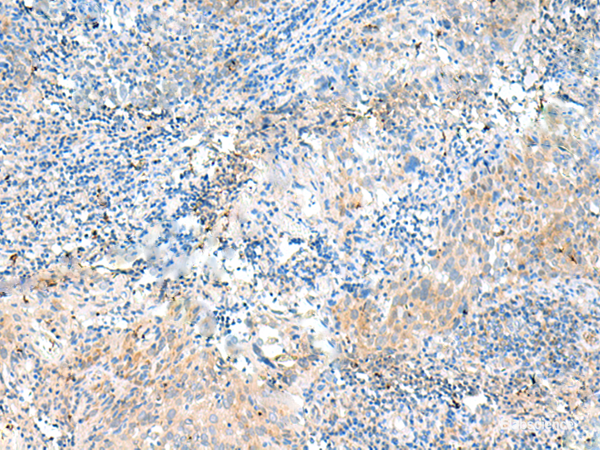 Anti-NID2