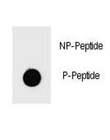 Anti-phospho-PARP1 (Ser864)