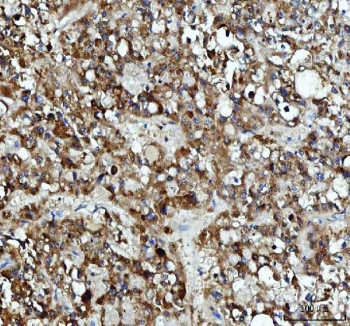 Anti-DCTPP1 / dCTP pyrophosphatase 1 / XTP3TPA