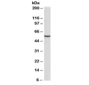Anti-ALDH6A1