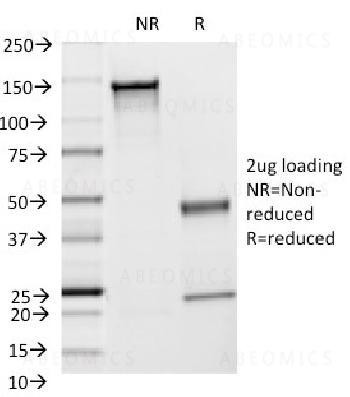 Anti-CD54 / ICAM-1 Monoclonal Antibody (Clone: F4-31C2)