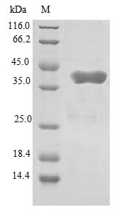 Glutamyl-tRNA (Gln) amidotransferase subunit C, mitochondrial (GATC), human, recombinant