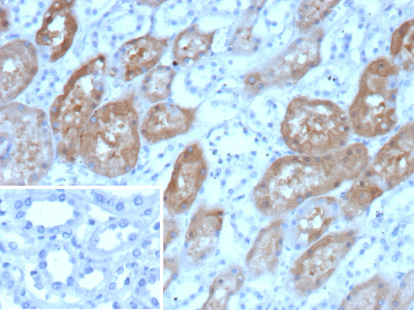 Anti-Cadherin-6 (CDH6) / K-Cadherin, clone CDH6/9347