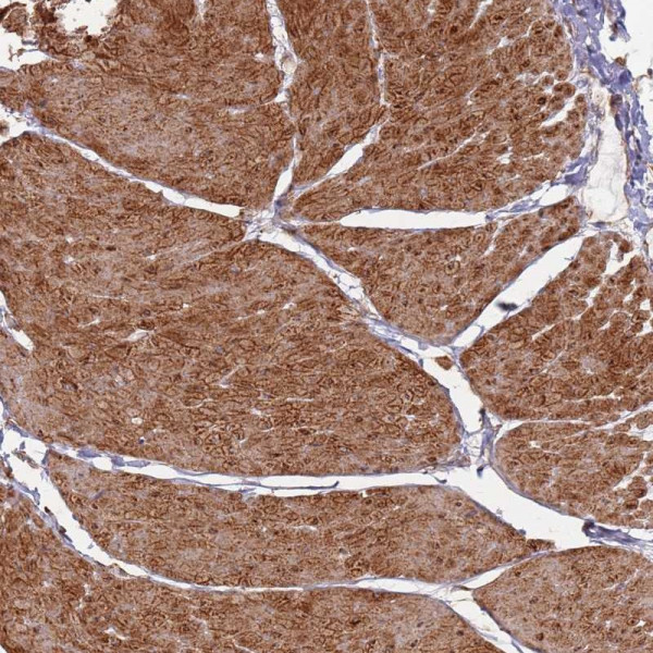 Anti-PHF21A
