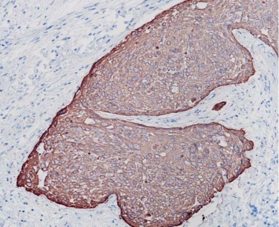 Anti-Cytokeratin 6, clone SQab18113