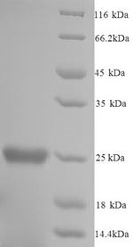 Glutathione S-transferase P 1 (Gstp1), mouse, recombinant