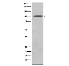 Anti-CD10 / Neprilysin, clone GEH-13