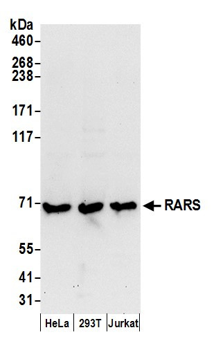 Anti-RARS
