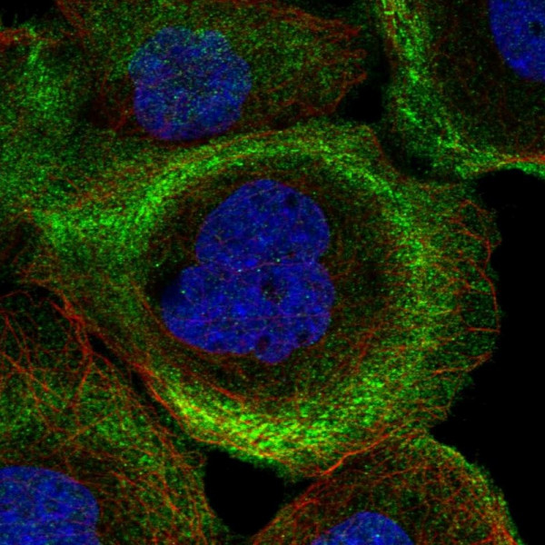 Anti-PHLDB2