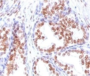 Anti-Androgen Receptor, clone DHTR/882