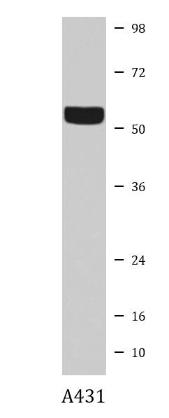 Anti-Cytokeratin 2e