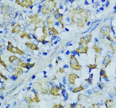 Anti-Cathepsin B