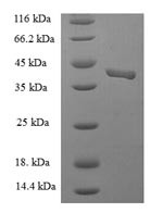 Endothelial cell-selective adhesion molecule (ESAM), partial, human, recombinant