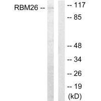 Anti-RBM26