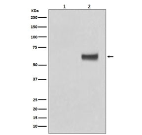 Anti-Estrogen Receptor alpha (pS118), clone EIG-5