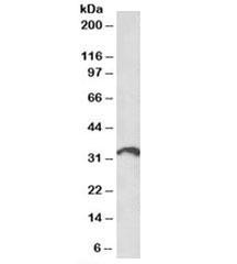 Anti-ICOS ligand