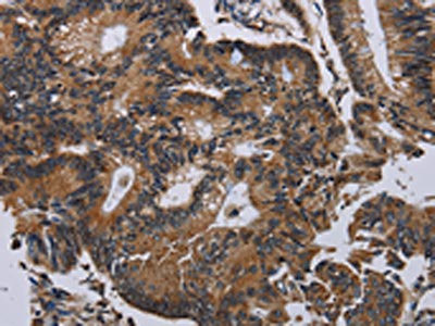 Anti-PCDHAC1