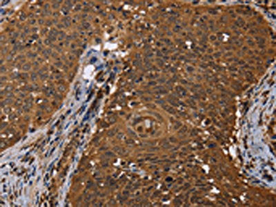 Anti-DCP1A