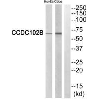 Anti-CCDC102B